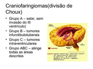 Craniofaringiomas(divisão de 
Choux) 
• Grupo A – selar, sem 
invasão do III 
ventrículo) 
• Grupo B – tumores 
infundibulotuberais 
• Grupo C – tumores 
intraventriculares 
• Grupo ABC – atinge 
todas as áreas 
descritas 
 