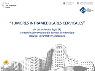 “TUMORES INTRAMEDULARES CERVICALES”
Dr. Cesar Peralta Rojas (R)
Unidad de Neurorradiología. Servicio de Radiología
Hospital Vall d’Hebron, Barcelona
 