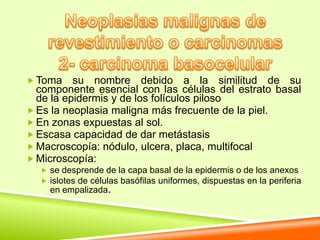  Toma    su nombre debido a la similitud de su
  componente esencial con las células del estrato basal
  de la epidermis y de los folículos piloso
 Es la neoplasia maligna más frecuente de la piel.
 En zonas expuestas al sol.
 Escasa capacidad de dar metástasis
 Macroscopía: nódulo, ulcera, placa, multifocal
 Microscopía:
   se desprende de la capa basal de la epidermis o de los anexos
   islotes de células basófilas uniformes, dispuestas en la periferia
    en empalizada.
 