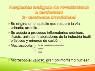 Se origina en el epitelio que recubre la vía
 urinaria: urotelio .
Se asocia a procesos inflamatorios crónicos,
 litiasis, anilinas, trabajadores de la industria textil,
 plásticos y mineros de carbón.
Macroscopía         Papilar: puede ser multicentrico
                    Sólido
                    Mixto



Microscopía: velloso, gran polimorfismo nuclear.
 