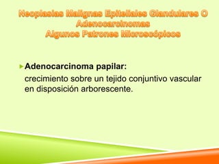 Adenocarcinoma papilar:
 crecimiento sobre un tejido conjuntivo vascular
 en disposición arborescente.
 
