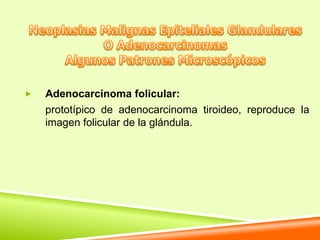    Adenocarcinoma folicular:
    prototípico de adenocarcinoma tiroideo, reproduce la
    imagen folicular de la glándula.
 