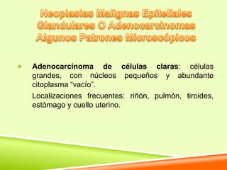    Adenocarcinoma de células claras: células
    grandes, con núcleos pequeños y abundante
    citoplasma “vacío”.
    Localizaciones frecuentes: riñón, pulmón, tiroides,
    estómago y cuello uterino.
 
