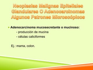  Adenocarcinoma mucosecretante o mucinoso:
     - producción de mucina
     - células caliciformes

  Ej.: mama, colon.
 