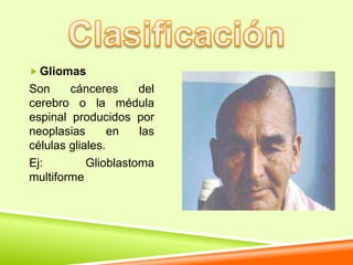  Gliomas
Son     cánceres      del
cerebro o la médula
espinal producidos por
neoplasias       en   las
células gliales.
Ej:         Glioblastoma
multiforme
 