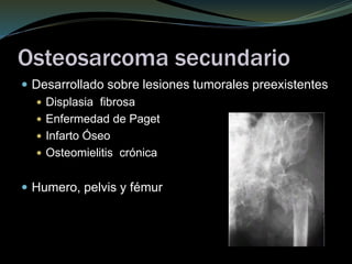 Osteosarcoma secundario
 Desarrollado sobre lesiones tumorales preexistentes
 Displasia fibrosa
 Enfermedad de Paget
 Infarto Óseo
 Osteomielitis crónica
 Humero, pelvis y fémur
 