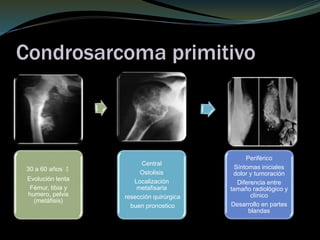 Condrosarcoma primitivo
30 a 60 años ♂
Evolución lenta
Fémur, tibia y
humero, pelvis
(metáfisis)
Central
Ostolisis
Localización
metafisaria
resección quirúrgica
buen pronostico
Periférico
Síntomas iniciales
dolor y tumoración
Diferencia entre
tamaño radiológico y
clínico
Desarrollo en partes
blandas
 