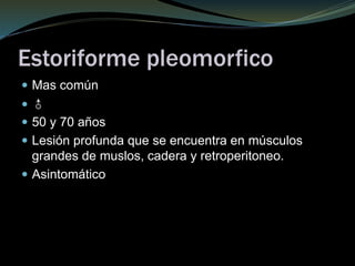 Estoriforme pleomorfico
 Mas común
 ♂
 50 y 70 años
 Lesión profunda que se encuentra en músculos
grandes de muslos, cadera y retroperitoneo.
 Asintomático
 