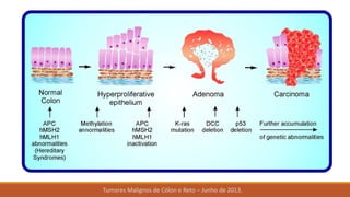 Tumores Malignos de Cólon e Reto – Junho de 2013.
 