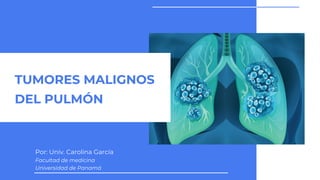 TUMORES MALIGNOS
DEL PULMÓN
Por: Univ. Carolina García
Facultad de medicina
Universidad de Panamá
 