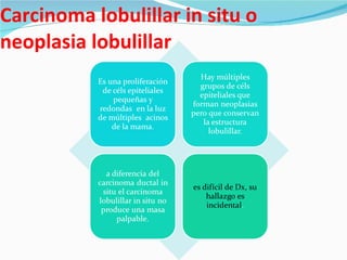 Carcinoma lobulillar in situ o neoplasia lobulillar 