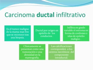 Carcinoma  ductal  infiltrativo  