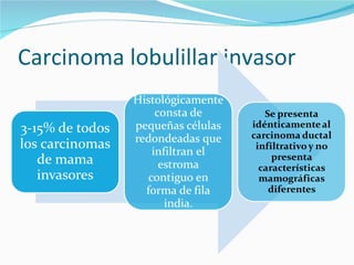 Carcinoma lobulillar invasor  