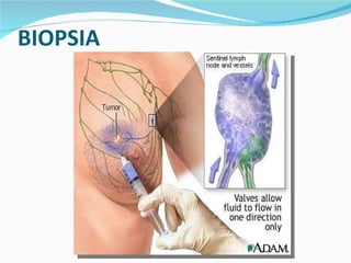 BIOPSIA 