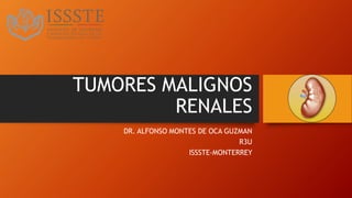 TUMORES MALIGNOS
RENALES
DR. ALFONSO MONTES DE OCA GUZMAN
R3U
ISSSTE-MONTERREY
 