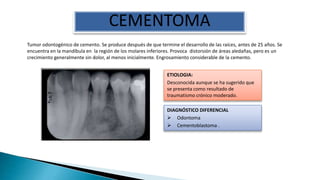 Tumores Odontogenicos | PPTX