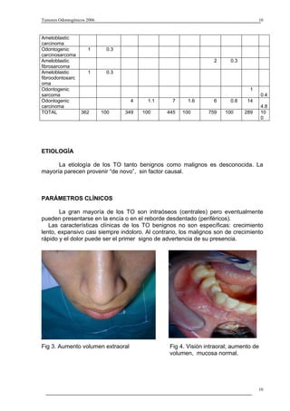 Tumores Odontogénicos 2006                                                           10



Ameloblastic
carcinoma
Odontogenic           1       0.3
carcinosarcoma
Ameloblastic                                                       2     0.3
fibrosarcoma
Ameloblastic          1       0.3
fibroodontosarc
oma
Odontogenic                                                                      1
sarcoma                                                                                 0.4
Odontogenic                           4     1.1     7     1.6      6     0.8    14
carcinoma                                                                               4.8
TOTAL              362       100    349   100     445   100      759   100     289      10
                                                                                        0




ETIOLOGÍA

      La etiología de los TO tanto benignos como malignos es desconocida. La
mayoría parecen provenir “de novo”, sin factor causal.



PARÁMETROS CLÍNICOS

       La gran mayoría de los TO son intraóseos (centrales) pero eventualmente
pueden presentarse en la encía o en el reborde desdentado (periféricos).
   Las características clínicas de los TO benignos no son específicas: crecimiento
lento, expansivo casi siempre indoloro. Al contrario, los malignos son de crecimiento
rápido y el dolor puede ser el primer signo de advertencia de su presencia.




Fig 3. Aumento volumen extraoral                  Fig 4. Visión intraoral; aumento de
                                                  volumen, mucosa normal.




                                                                                     10
 