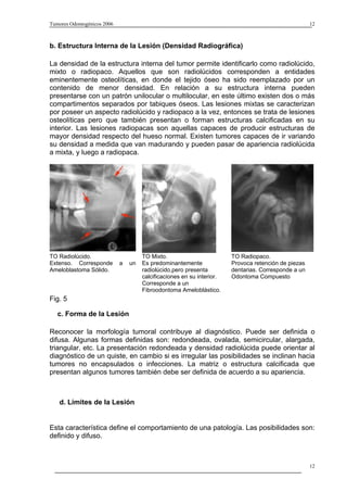 Tumores Odontogénicos 2006                                                                            12



b. Estructura Interna de la Lesión (Densidad Radiográfica)

La densidad de la estructura interna del tumor permite identificarlo como radiolúcido,
mixto o radiopaco. Aquellos que son radiolúcidos corresponden a entidades
eminentemente osteolíticas, en donde el tejido óseo ha sido reemplazado por un
contenido de menor densidad. En relación a su estructura interna pueden
presentarse con un patrón unilocular o multilocular, en este último existen dos o más
compartimentos separados por tabiques óseos. Las lesiones mixtas se caracterizan
por poseer un aspecto radiolúcido y radiopaco a la vez, entonces se trata de lesiones
osteolíticas pero que también presentan o forman estructuras calcificadas en su
interior. Las lesiones radiopacas son aquellas capaces de producir estructuras de
mayor densidad respecto del hueso normal. Existen tumores capaces de ir variando
su densidad a medida que van madurando y pueden pasar de apariencia radiolúcida
a mixta, y luego a radiopaca.




TO Radiolúcido.                       TO Mixto.                         TO Radiopaco.
Extenso. Corresponde         a   un   Es predominantemente              Provoca retención de piezas
Ameloblastoma Sólido.                 radiolúcido,pero presenta         dentarias. Corresponde a un
                                      calcificaciones en su interior.   Odontoma Compuesto
                                      Corresponde a un
                                      Fibroodontoma Ameloblástico.
Fig. 5

   c. Forma de la Lesión

Reconocer la morfología tumoral contribuye al diagnóstico. Puede ser definida o
difusa. Algunas formas definidas son: redondeada, ovalada, semicircular, alargada,
triangular, etc. La presentación redondeada y densidad radiolúcida puede orientar al
diagnóstico de un quiste, en cambio si es irregular las posibilidades se inclinan hacia
tumores no encapsulados o infecciones. La matriz o estructura calcificada que
presentan algunos tumores también debe ser definida de acuerdo a su apariencia.



   d. Límites de la Lesión


Esta característica define el comportamiento de una patología. Las posibilidades son:
definido y difuso.



                                                                                                      12
 