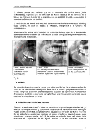 Tumores Odontogénicos 2006                                                                 13



El primero posee una variante que es la presencia de cortical ósea (límite
corticalizado), explicada por la formación de hueso reactivo en la periferia de la
lesión. Un margen definido es la expresión de un proceso crónico, encapsulado o
con características de benignidad.

El límite difuso se refiere a la dificultad para definir la interfase entre tejido normal y
tejido tumoral, lo cual se asocia a infección, malignidad o a tumores no
encapsulados.

Adicionalmente, existe otra variedad de contorno definido que es el festoneado,
identificable como una serie de semicírculos o arcos contiguos reflejan el mecanismo
de crecimiento de la lesión.




Límite Definido de Tipo       Límite Difuso.                          Borde Festoneado.
Corticalizado.                Es una Displasia Fibrosa en             En la parte posterior de
Se trata de un TO             mandíbula. Es difícil establecer la     un TO Queratoquiste.
Queratoquiste.                interfase tejido sano-tejido enfermo.

Fig. 6

   e. Tamaño

Se trata de determinar con la mayor precisión posible las dimensiones reales del
tumor en los tres sentidos del espacio. Relacionar el tamaño que presenta una lesión
con su tiempo de evolución, orienta respecto a su grado de agresividad. Conocer sus
dimensiones también es relevante para planificar una intervención quirúrgica o para
controlar la evolución de un tumor


   f. Relación con Estructuras Vecinas

Evaluar los efectos de la lesión sobre las estructuras adyacentes permite al radiólogo
deducir su comportamiento y contribuye a identificar la naturaleza de la patología.
Puede existir proximidad, desplazamiento, ocupación o invasión del tumor respecto
de las estructuras anatómicas vecinas (ej: senos maxilares, cavidad nasal, canal
mandibular, foramen mental, etc). Si la lesión se extiende fuera del hueso debe
evaluarse el compromiso de los tejidos blandos y de los diferentes espacios



                                                                                           13
 