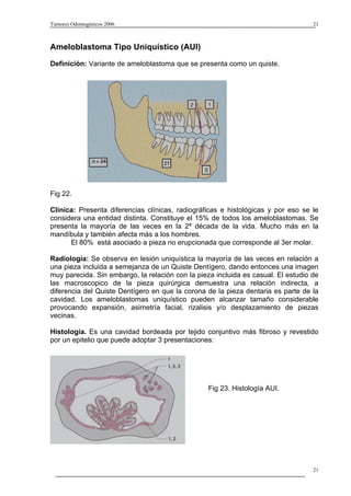 Tumores Odontogénicos 2006                                                         21



Ameloblastoma Tipo Uniquístico (AUI)
Definición: Variante de ameloblastoma que se presenta como un quiste.




Fig 22.

Clínica: Presenta diferencias clínicas, radiográficas e histológicas y por eso se le
considera una entidad distinta. Constituye el 15% de todos los ameloblastomas. Se
presenta la mayoría de las veces en la 2ª década de la vida. Mucho más en la
mandíbula y también afecta más a los hombres.
      El 80% está asociado a pieza no erupcionada que corresponde al 3er molar.

Radiología: Se observa en lesión uniquística la mayoría de las veces en relación a
una pieza incluida a semejanza de un Quiste Dentígero, dando entonces una imagen
muy parecida. Sin embargo, la relación con la pieza incluida es casual. El estudio de
las macroscopico de la pieza quirúrgica demuestra una relación indirecta, a
diferencia del Quiste Dentígero en que la corona de la pieza dentaria es parte de la
cavidad. Los ameloblastomas uniquístico pueden alcanzar tamaño considerable
provocando expansión, asimetría facial, rizalisis y/o desplazamiento de piezas
vecinas.

Histología. Es una cavidad bordeada por tejido conjuntivo más fibroso y revestido
por un epitelio que puede adoptar 3 presentaciones:




                                                  Fig 23. Histología AUI.




                                                                                   21
 
