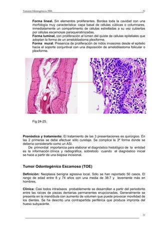 Tumores Odontogénicos 2006                                                           22



        Forma lineal. Sin elementos proliferantes. Bordea toda la cavidad con una
        morfología muy característica: capa basal de células cúbicas o columnares,
        inmediatamente un compartimento de células estrelladas a su vez cubiertas
        por células escamosas paraqueratinizadas.
        Forma luminal, con proliferación al lúmen del quiste de células epiteliales que
        adoptan la forma de un ameloblastoma plexiforme.
        Forma mural. Presencia de proliferación de nidos invasores desde el epitelio
        hacia el soporte conjuntival con una disposición de ameloblastoma folicular o
        plexiforme.




        Fig 24-25.



Pronóstico y tratamiento: El tratamiento de las 3 presentaciones es quirúrgico. En
las 2 primeras se debe efectuar sólo curetaje. Se complica la 3ª forma donde se
debería considerarlo como un ASI.
    De primordial importancia para elaborar el diagnóstico histológico de la entidad
es la información clínica y radiográfica, sobretodo cuando el diagnóstico inicial
se hace a partir de una biopsia incisional.


Tumor Odontogénico Escamoso (TOE)
Definición: Neoplasia benigna agresiva local. Sólo se han reportado 50 casos. El
rango de edad entre 8 y 74 años con una media de 38.7 y levemente más en
hombres.

Clínica: Casi todos intraóseos probablemente se desarrollan a partir del periodonto
entre las raíces de piezas dentarias permanentes erupcionadas. Generalmente se
presenta en la mandíbula con aumento de volumen que puede provocar movilidad de
los dientes. Se ha descrito una contrapartida periférica que produce impronta del
hueso subyacente.


                                                                                     22
 