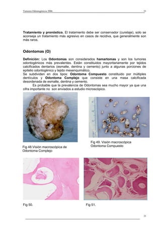 Tumores Odontogénicos 2006                                                     33




Tratamiento y pronóstico. El tratamiento debe ser conservador (curetaje), solo se
aconseja un tratamiento más agresivo en casos de recidiva, que generalmente son
más raros.


Odontomas (O)
Definición: Los Odontomas son considerados hamartomas y son los tumores
odontogénicos más prevalentes. Están constituidos mayoritariamente por tejidos
calcificados dentarios (esmalte, dentina y cemento) junto a algunas porciones de
epitelio odontogénico y tejido mesenquimático.
Se subdividen en dos tipos: Odontoma Compuesto constituido por múltiples
dentículos y Odontoma Complejo que consiste en una masa calcificada
desordenada de esmalte, dentina y cemento.
        Es probable que la prevalencia de Odontomas sea mucho mayor ya que una
cifra importante no son enviados a estudio microscópico.




                                            Fig 49. Visión macroscópica
Fig 48.Visión macroscópica de               Odontoma Compuesto
Odontoma Complejo




Fig 50.                                  Fig 51.


                                                                               33
 