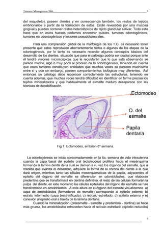 Tumores Odontogénicos 2006                                                                5



del esqueleto), poseen dientes y en consecuencia también, los restos de tejidos
embrionarios a partir de la formación de estos. Están revestidos por una mucosa
gingival y pueden contener restos heterotópicos de tejido glandular salivar. Todo esto
hace que en estos huesos podamos encontrar quistes, tumores odontogénicos,
tumores no odontogénicos y lesiones pseudotumorales.

       Para una comprensión global de la morfología de los T.O. es necesario tener
presente que estos reproducen aberrantemente todas o algunas de las etapas de la
odontogénesis, por lo tanto es necesario recordar algunos conceptos básicos del
desarrollo de los dientes, situación que para el patólogo podría ser crucial porque ante
él tendrá visiones microscópicas que le recordarán que lo que está observando se
parece mucho, algo o muy poco al proceso de la odontogénesis, teniendo en cuenta
que estos tumores constituyen entidades que muchas veces se parecen muchísimo
entre sí y que sin embargo, poseen comportamientos biológicos muy diferentes. Así
entonces un patólogo debe reconocer correctamente las estructuras, teniendo en
cuenta además, que muchas veces tendrá dificultad en identificar en forma precisa los
tejidos mineralizados y que habitualmente el esmalte maduro desaparece con las
técnicas de decalcificación.

                                                                              Ectomodeo


                                                                             O. del
                                                                             esmalte

                                                                           Papila
                                                                           dentaria

                             Fig 1. Ectomodeo, embrión 8ª semana.


   La odontogénesis se inicia aproximadamente en la 6a. semana de vida intrauterina
cuando la capa basal del epitelio oral (ectomodeo) prolifera hacia el mesénquima
formando la lámina dental de la cual se derivan a su vez los órganos del esmalte, que a
medida que avanza el desarrollo, adquiere la forma de la corona del diente a la que
dará origen, mientras tanto las células mesenquimáticas de la papila, adyacentes al
epitelio del órgano del esmalte se diferencian en odontoblastos, que elaboran
predentina que se transformará en dentina definitiva, el resto de las células formarán la
pulpa del diente, en este momento las células epiteliales del órgano del esmalte se han
transformado en ameloblastos. A esta altura en el órgano del esmalte visualizamos a)
capa de ameloblastos (formadores de esmalte) corresponde al epitelio externo; b)
estrato intermedio (capa biestratificada); c) retículo estrellado; d) epitelio externo y e)
conexión al epitelio oral a través de la lámina dentaria.
        Cuando la mineralización (preesmalte - esmalte y predentina - dentina) se hace
más gruesa, los ameloblastos retroceden hacia el retículo estrellado (epitelio reducido)


                                                                                          5
 