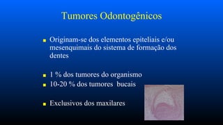 Tumores Odontogênicos
■ Originam-se dos elementos epiteliais e/ou
mesenquimais do sistema de formação dos
dentes
■ 1 % dos tumores do organismo
■ 10-20 % dos tumores bucais
■ Exclusivos dos maxilares
 