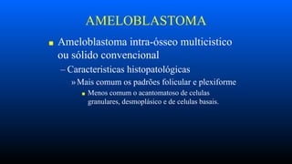 AMELOBLASTOMA
■ Ameloblastoma intra-ósseo multicistico
ou sólido convencional
– Caracteristicas histopatológicas
»Mais comum os padrões folicular e plexiforme
■ Menos comum o acantomatoso de celulas
granulares, desmoplásico e de celulas basais.
 