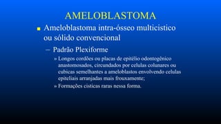 AMELOBLASTOMA
■ Ameloblastoma intra-ósseo multicistico
ou sólido convencional
– Padrão Plexiforme
» Longos cordões ou placas de epitélio odontogênico
anastomosados, circundados por celulas colunares ou
cubicas semelhantes a ameloblastos envolvendo celulas
epiteliais arranjadas mais frouxamente;
» Formações cisticas raras nessa forma.
 