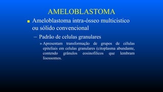 AMELOBLASTOMA
■ Ameloblastoma intra-ósseo multicistico
ou sólido convencional
– Padrão de celulas granulares
» Apresentam transformação de grupos de células
epiteliais em celulas granulares (citoplasma abundante,
contendo grânulos eosinofilicos que lembram
lisossomos.
 