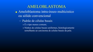 AMELOBLASTOMA
■ Ameloblastoma intra-ósseo multicistico
ou sólido convencional
– Padrão de células basais
» É o tipo menos comum;
» Ninhos de celulas basais uniformes, histologicamente
semelhante ao carcinoma de celulas basais da pele.
 