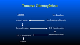 Tumores Odontogênicos
Epitelio Mesênquima
Mesênquima subjacente
Lámina dental
Preameloblastos Dif. Odontoblastos
Predentina-dentina
Dif. Ameloblastos
Esmalte
 