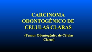CARCINOMA
ODONTOGÊNICO DE
CELULAS CLARAS
(Tumor Odontogênico de Células
Claras)
 