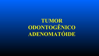 TUMOR
ODONTOGÊNICO
ADENOMATÓIDE
 