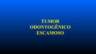TUMOR
ODONTOGÊNICO
ESCAMOSO
 