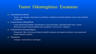 Tumor Odontogênico Escamoso
■ Características clínicas
– Tumor raro, benigno, intra-ósseo ou periférico, originário da lamina dentaria ou dos restos epiteliais
de malassez.
■ Caracteristicas radiográficas
– Lesão radiolúcida triangular, lateralmente as raizes dos dentes, sugerindo perda óssea vertical
decorrente de provlema periodontal, não excedendo 1,5 cm no seu > diâmetro.
■ Características histopatológicas
– Presença de ilhas de diversas formas de epitelio escamoso com aspecto inofensivo, num estroma de
tecido conjuntivo maduro.
■ Tratamento
– Cirúrgico conservador ou curetagem.
 