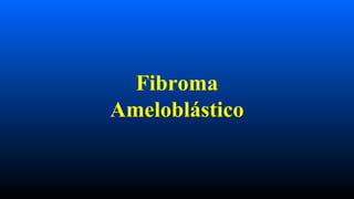 Fibroma
Ameloblástico
 