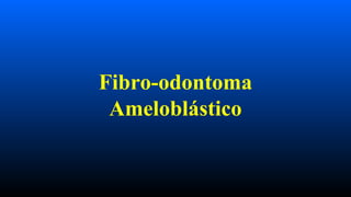 Fibro-odontoma
Ameloblástico
 