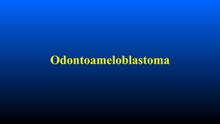Odontoameloblastoma
 