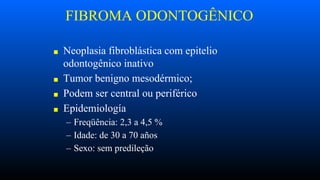 FIBROMA ODONTOGÊNICO
■ Neoplasia fibroblástica com epitelio
odontogênico inativo
■ Tumor benigno mesodérmico;
■ Podem ser central ou periférico
■ Epidemiología
– Freqüência: 2,3 a 4,5 %
– Idade: de 30 a 70 años
– Sexo: sem predileção
 