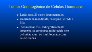 Tumor Odontogênico de Celulas Granulares
■ Lesão rara; 20 casos documentados;
■ Ocorrem na mandibula, na região de PMs e
Ms;
■ Assintomaticos , radiograficamente
apresenta-se como área radiolucida bem
delimitada, uni ou multiloculada com
calcificações.
 