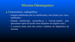Mixoma Odontogenico
■ Caracteristicas radiográficas
– imagem radiolúcida (uni ou multilocular), com limites, por vezes,
indefinidos.;
– Quando multilocular, assemelha-se a “teia-de-aranha”, pois
apresentam septos de tecido ósseo dispostos em ângulos retos.;
– A ausência deste sinal não exclui a hipótese do diagnóstico de
mixoma.
 