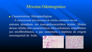 Mixoma Odontogenico
■ Caracteristicas Histopatológicas
– É caracterizado pela presença de células estreladas em um
estroma abundante em mucopolissacarídeos ácidos. Muitas
dessas células têm características ultra-estruturais semelhantes
aos miofibroblastos, o que sustentaria a hipótese de origem
mesenquimal da lesão.
 