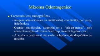 Mixoma Odontogenico
■ Caracteristicas radiográficas
– imagem radiolúcida (uni ou multilocular), com limites, por vezes,
indefinidos.;
– Quando multilocular, assemelha-se a “teia-de-aranha”, pois
apresentam septos de tecido ósseo dispostos em ângulos retos.;
– A ausência deste sinal não exclui a hipótese do diagnóstico de
mixoma.
 