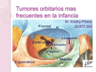 Tumores orbitarios mas
frecuentes en la infancia
Br: Emilhy Piñero
20.877.364
 