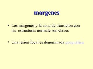 margenesmargenes
• Los margenes y la zona de transicion con
las estructuras normale son claves
• Una lesion focal es denominada geografica
 