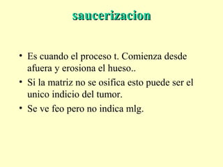saucerizacionsaucerizacion
• Es cuando el proceso t. Comienza desde
afuera y erosiona el hueso..
• Si la matriz no se osifica esto puede ser el
unico indicio del tumor.
• Se ve feo pero no indica mlg.
 