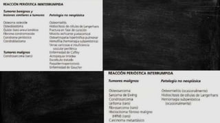 Comprehensive Overview of Bone Tumors: Classification, Imaging, and ...