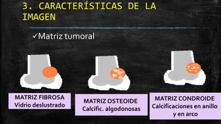 Comprehensive Overview of Bone Tumors: Classification, Imaging, and ...